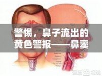 警惕，鼻子流出的黃色警報(bào)——鼻竇炎的真相與應(yīng)對(duì)策略