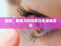 揭秘，眼角為何總有白色液體流出