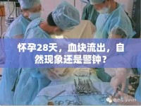 懷孕28天，血塊流出，自然現(xiàn)象還是警鐘？