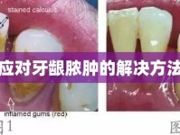 應對牙齦膿腫的解決方法