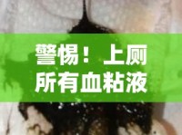 警惕！上廁所有血粘液流出，健康警鐘的信號
