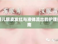 嬰兒眼皮發(fā)紅與液體流出的護理指南
