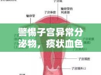 警惕子宮異常分泌物，痰狀血色背后的健康警報(bào)