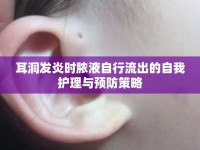 耳洞發(fā)炎時膿液自行流出的自我護理與預防策略