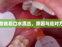拔智齒后口水流出，原因與應(yīng)對(duì)方法