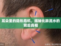 耳朵里的隱形危機，揭秘化膿流水的背后真相