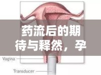 藥流后的期待與釋然，孕囊排出的時(shí)間與注意事項(xiàng)