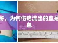 揭秘，為何傷疤流出的血是粉色