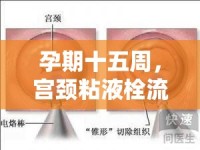 孕期十五周，宮頸粘液栓流出的奧秘與科學(xué)應(yīng)對(duì)策略