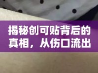 揭秘創(chuàng)可貼背后的真相，從傷口流出的液體究竟是什么？