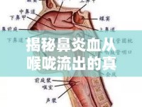 揭秘鼻炎血從喉嚨流出的真相