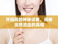 牙縫間的神秘訪客，揭秘突然流血的真相
