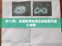 孕11周，宮頸粘液栓流出的秘密與安心指南