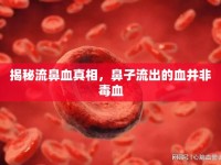 揭秘流鼻血真相，鼻子流出的血并非毒血