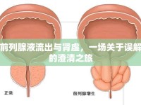 前列腺液流出與腎虛，一場(chǎng)關(guān)于誤解的澄清之旅