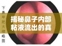 揭秘鼻子內(nèi)部粘液流出的真相與應(yīng)對(duì)策略