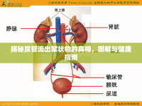 揭秘尿管流出絮狀物的真相，圖解與健康指南