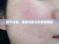 脖子過敏，瘙癢與膿水的真相揭秘