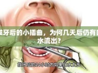 拔牙后的小插曲，為何幾天后仍有口水流出？