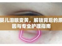 嬰兒淚眼變黃，解鎖背后的原因與專業(yè)護理指南