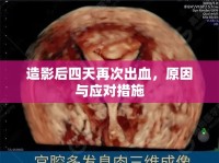 造影后四天再次出血，原因與應(yīng)對(duì)措施