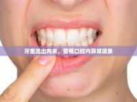 牙里流出肉來，警惕口腔內(nèi)異?，F(xiàn)象