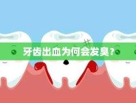 牙齒出血為何會(huì)發(fā)臭？