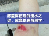 膝蓋擦傷后的流水之謎，應(yīng)急處理與科學(xué)護理全面指南