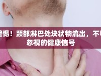 警惕！頸部淋巴處塊狀物流出，不可忽視的健康信號(hào)