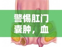 警惕肛門囊腫，血流出時，你需要了解的健康警報
