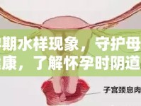 孕期水樣現(xiàn)象，守護(hù)母嬰健康，了解懷孕時陰道流液