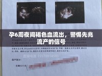 孕6周夜間褐色血流出，警惕先兆流產(chǎn)的信號