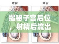 揭秘子宮后位，射精后流出的那些不為人知的秘密