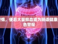 警惕，便后大量鮮血或?yàn)槟c道健康紅色警報(bào)