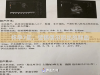 懷孕7周，警惕偶爾流出的鮮血