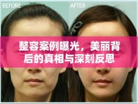 整容案例曝光，美麗背后的真相與深刻反思