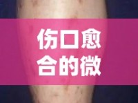 傷口愈合的微妙信號(hào)，結(jié)痂后出現(xiàn)白色血水的含義