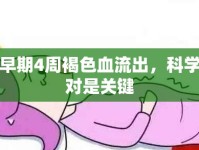 孕早期4周褐色血流出，科學(xué)應(yīng)對(duì)是關(guān)鍵