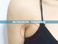 腋窩下腫塊與膿水流出，不容忽視的健康警報(bào)