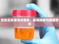 憋尿后尿液泡沫增多，真相揭秘與健康警示
