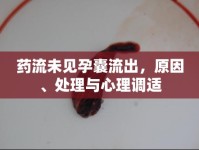 藥流未見孕囊流出，原因、處理與心理調(diào)適