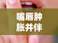 嘴唇腫脹并伴有白色物體流出，你需要了解的唇部異常解密