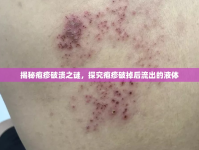 揭秘皰疹破潰之謎，探究皰疹破掉后流出的液體