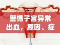 警惕子宮異常出血，原因、癥狀與應(yīng)對策略