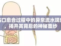 傷口愈合過程中的異常流水現(xiàn)象，揭開其背后的神秘面紗