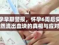 孕早期警報，懷孕6周后突然流出血塊的真相與應(yīng)對策略