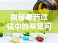 揭秘塞藥過程中的常見問題與解決策略