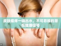 皮膚瘙癢一撓出水，不可忽視的潛在健康信號
