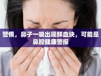 警惕，鼻子一吸出現(xiàn)鮮血塊，可能是鼻腔健康警報