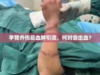 手臂外傷后血腫引流，何時(shí)會(huì)出血？